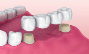Read more about the article McClane Dentistry